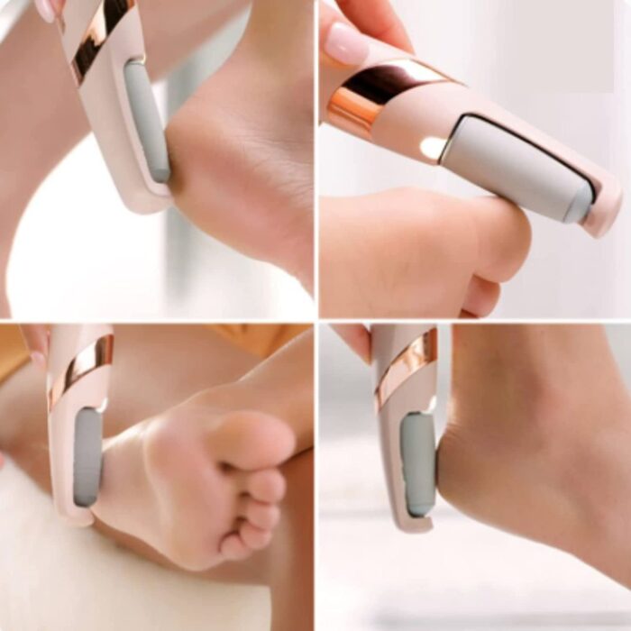 Callus Remover
