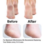 Callus Remover