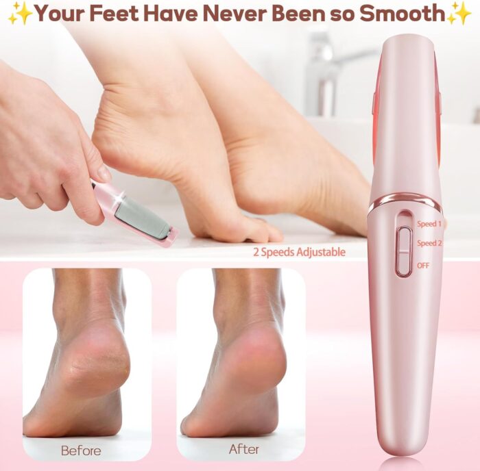 Electric Pedicure Tool